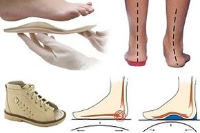 Orthopedic shoes for hallux valgus in a child