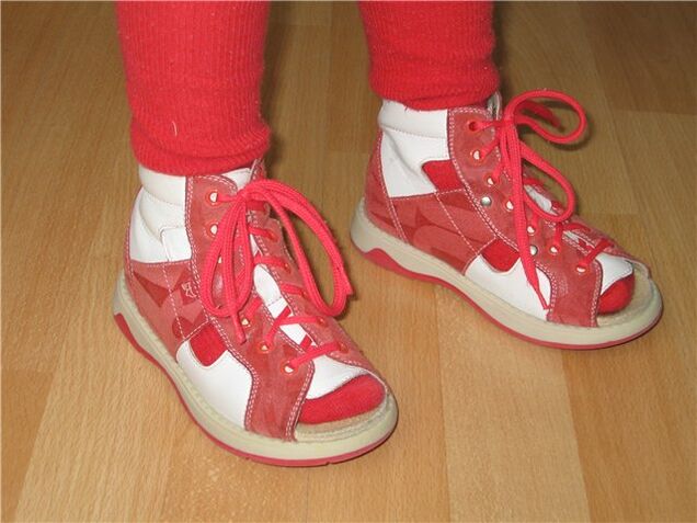 Shoes for children with hallux valgus