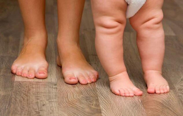 Valgus deformation of the foot in children