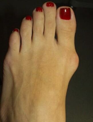 Clinical manifestations